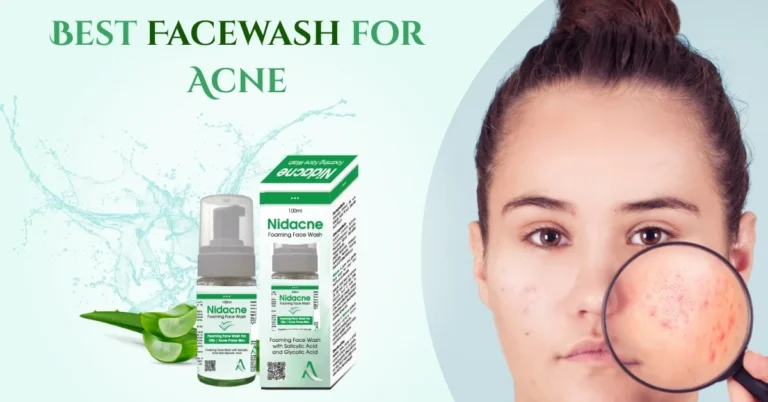 Best Facewash for Acne