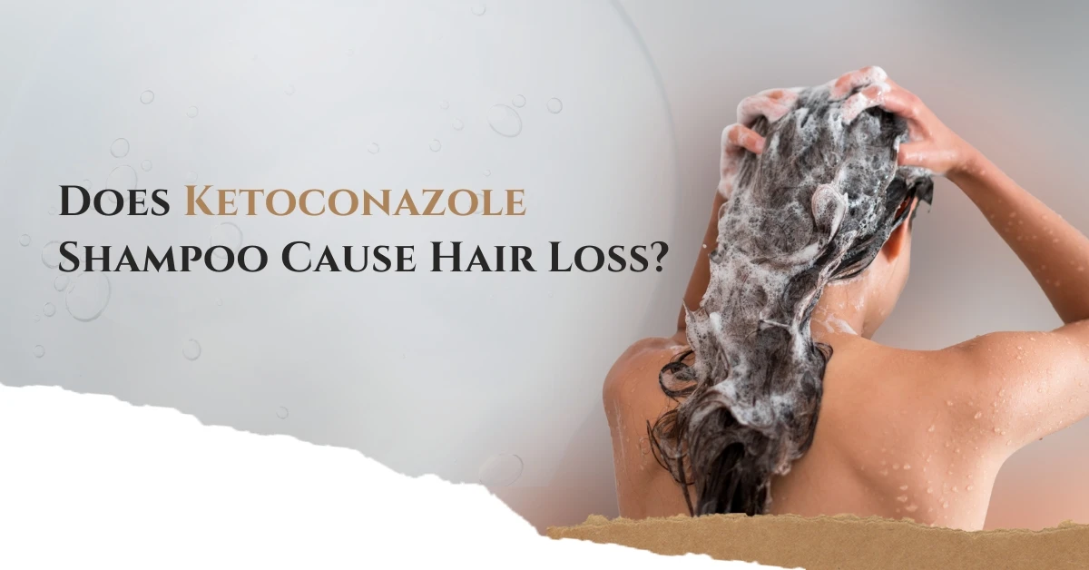 Does Ketoconazole Shampoo Cause Hair Loss