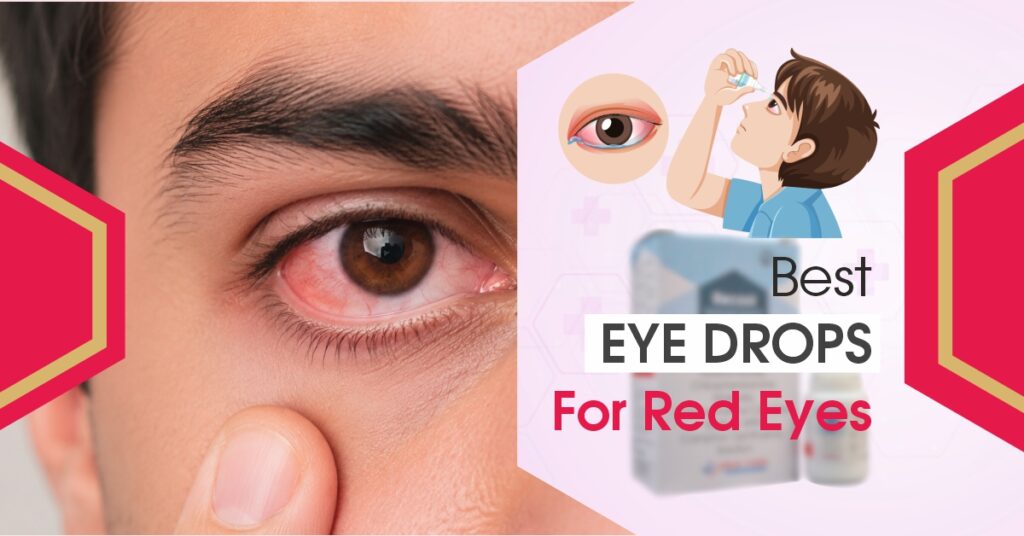 Best Eye Drops for Red Eyes: A Complete Guide